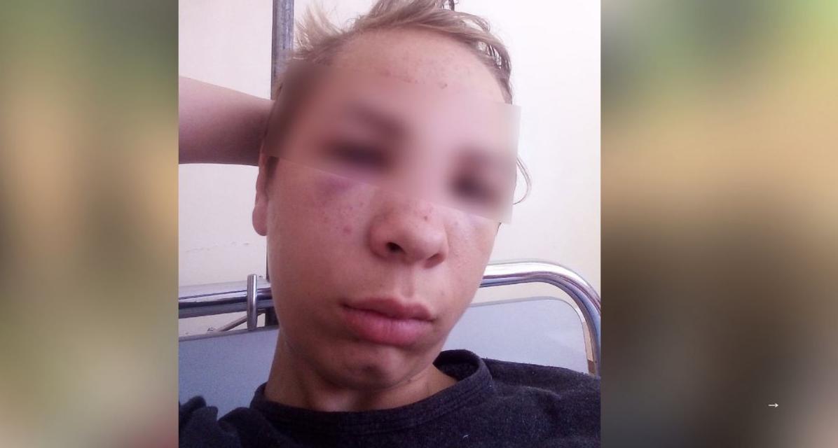 Сломал нос мальчику: избивающего детей мужчину задержали в Ярославской области