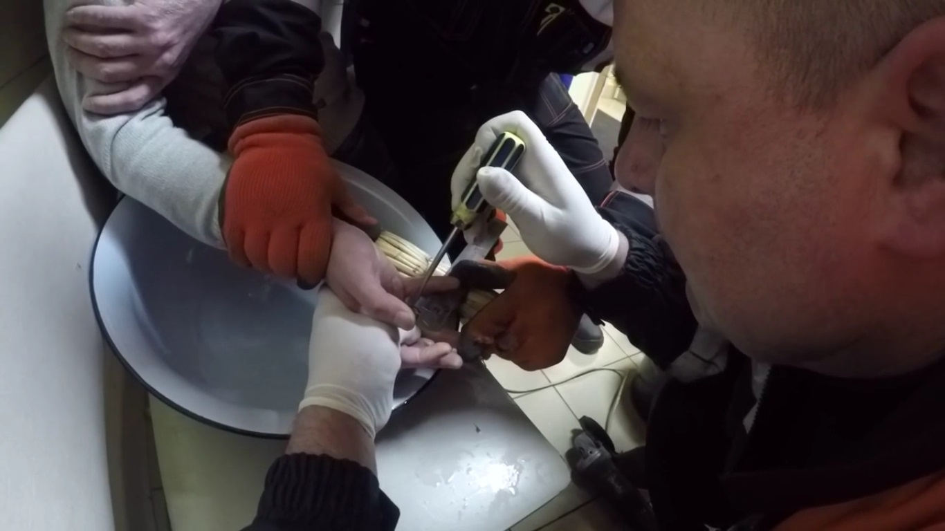 Ярославцу, окольцованному сантехнической шайбой, потребовалась помощь спасателей: видео