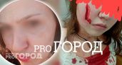 «Повалили в ванну и били»: порезавшая ножом лицо девочке ярославна дала интервью