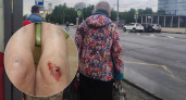  "Мама плачет от боли": под Ярославлем пенсионерка разбила лицо и колени из-за темноты в городе