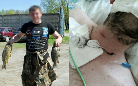 Черепно-мозговая травма и отек мозга: парень умер после двух недель в ярославском СИЗО