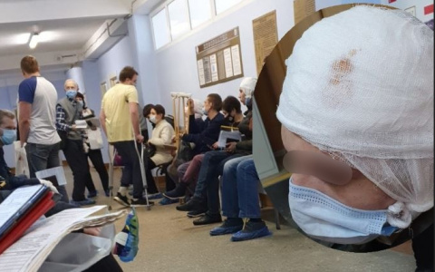 Пробили голову: охранников бара в центре Ярославля обвинили в избиении гостя