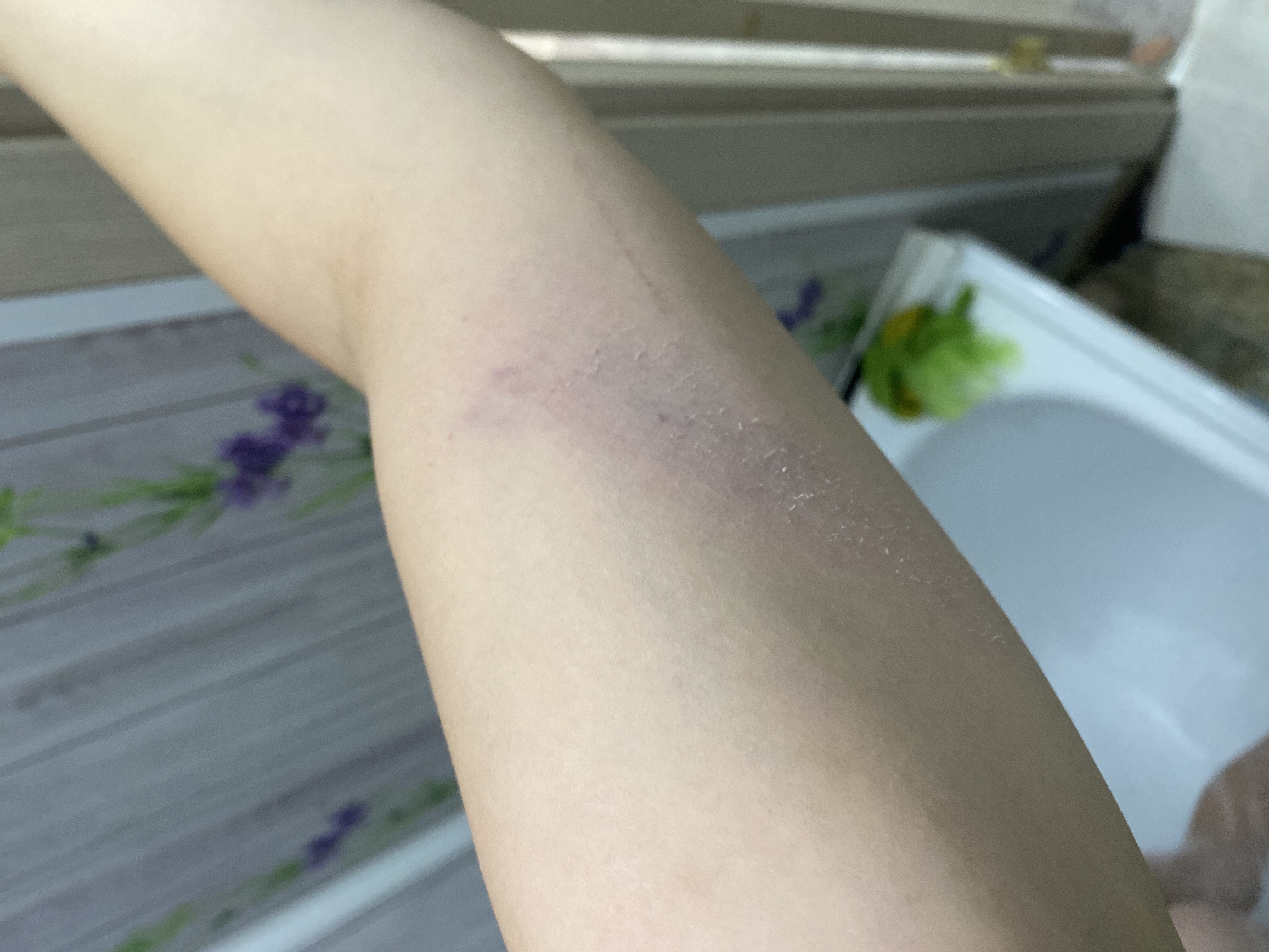 Изображение к жалобе