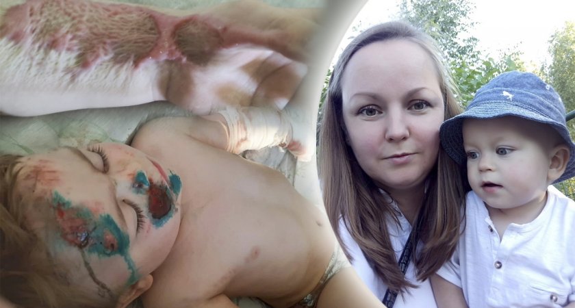 Мама из Ярославля требует тюрьмы для пьяного водителя, покалечившего ее малыша
