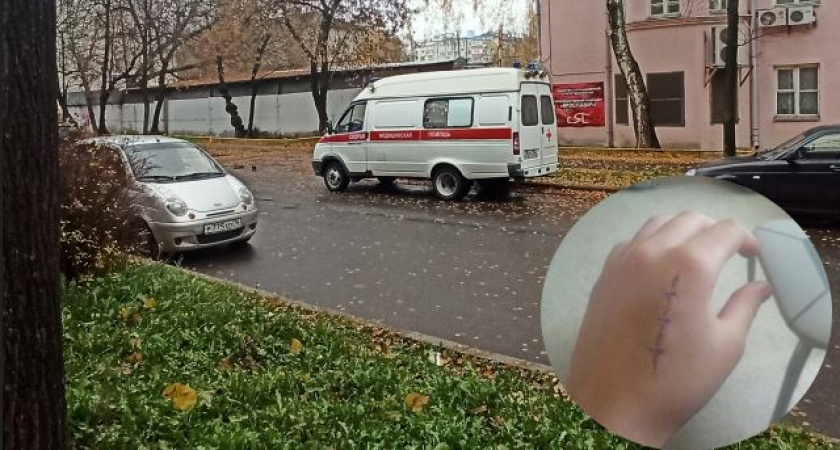 "Укус под кость": в Ярославле собака набросилась на 13-летнюю девочку
