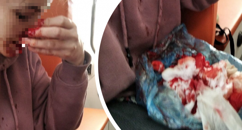 «Боялась не доехать»: из-за открывшегося в поезде кровотечения ярославна попала в больницу