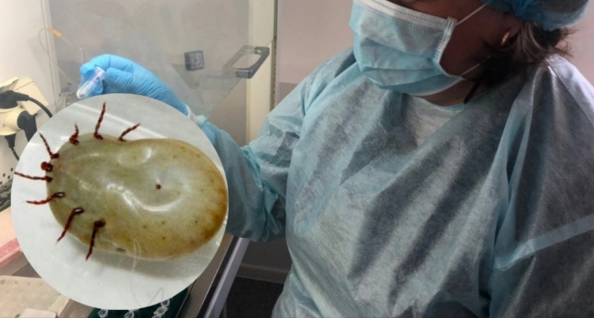 Накачать водкой: назвали 3 способа казнить клеща 