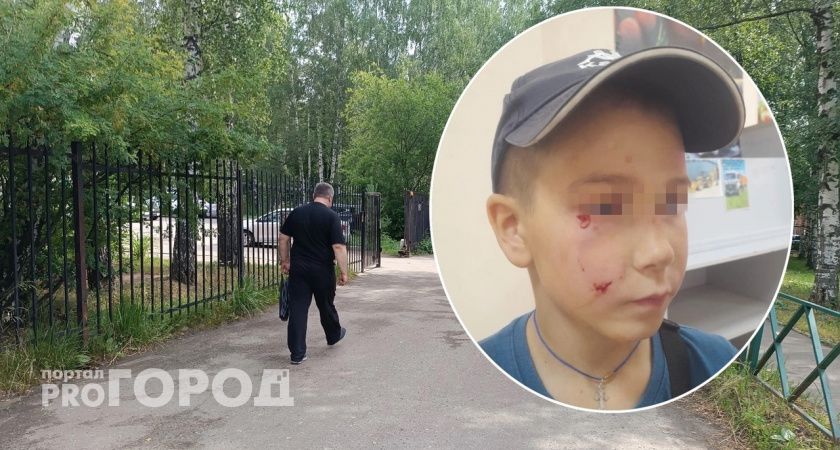 Собачий беспредел в Ярославле: из-за животных режут людей