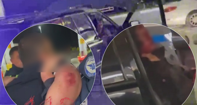 В Москве у водителя с ярославскими номерами обнаружили раненную девушку без пальца