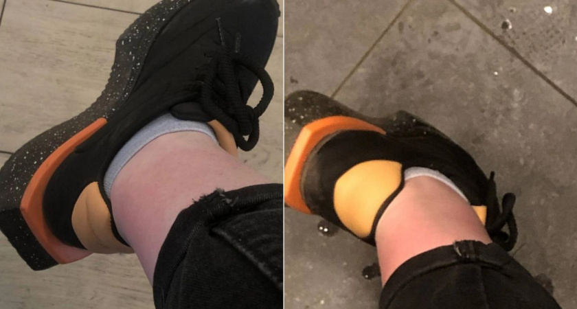 Ярославна поджарила ноги до красной корки в автобусе