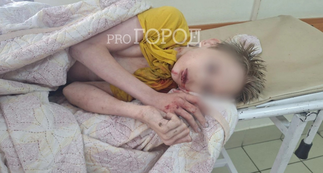 Наказать виновных в деле о придавленном столбом мальчике требует Бастрыкин