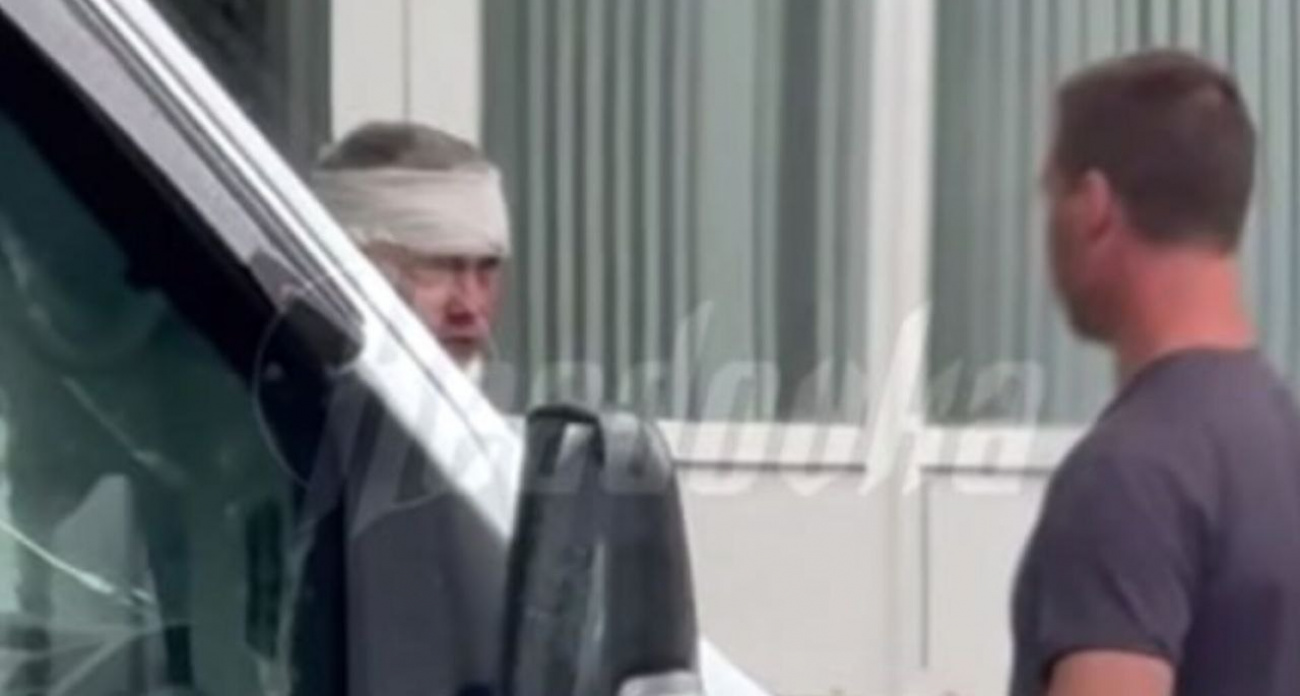 Мужу Блиновской таксист разбил голову и нос