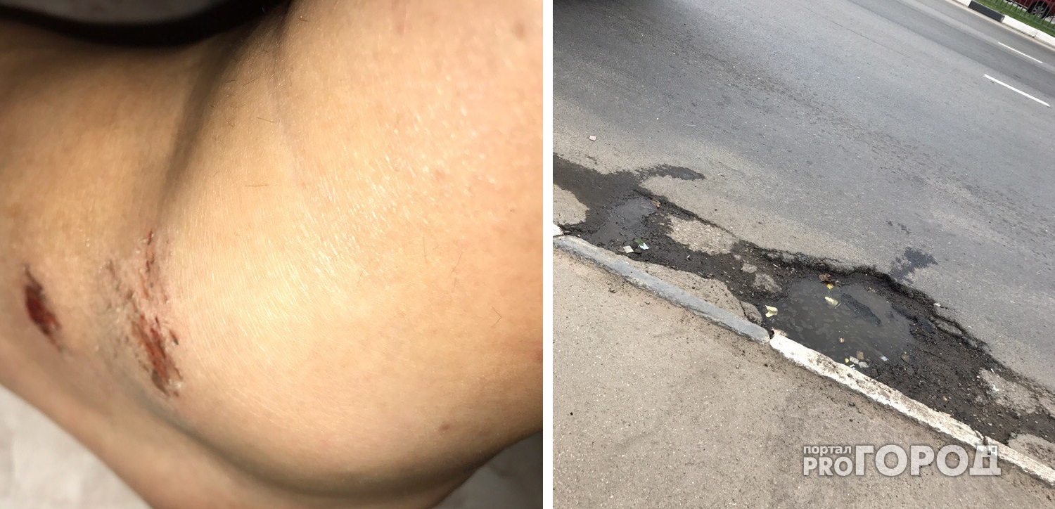 Выбоину на ярославской дороге, из-за которой девушка повредила ногу, решили отремонтировать