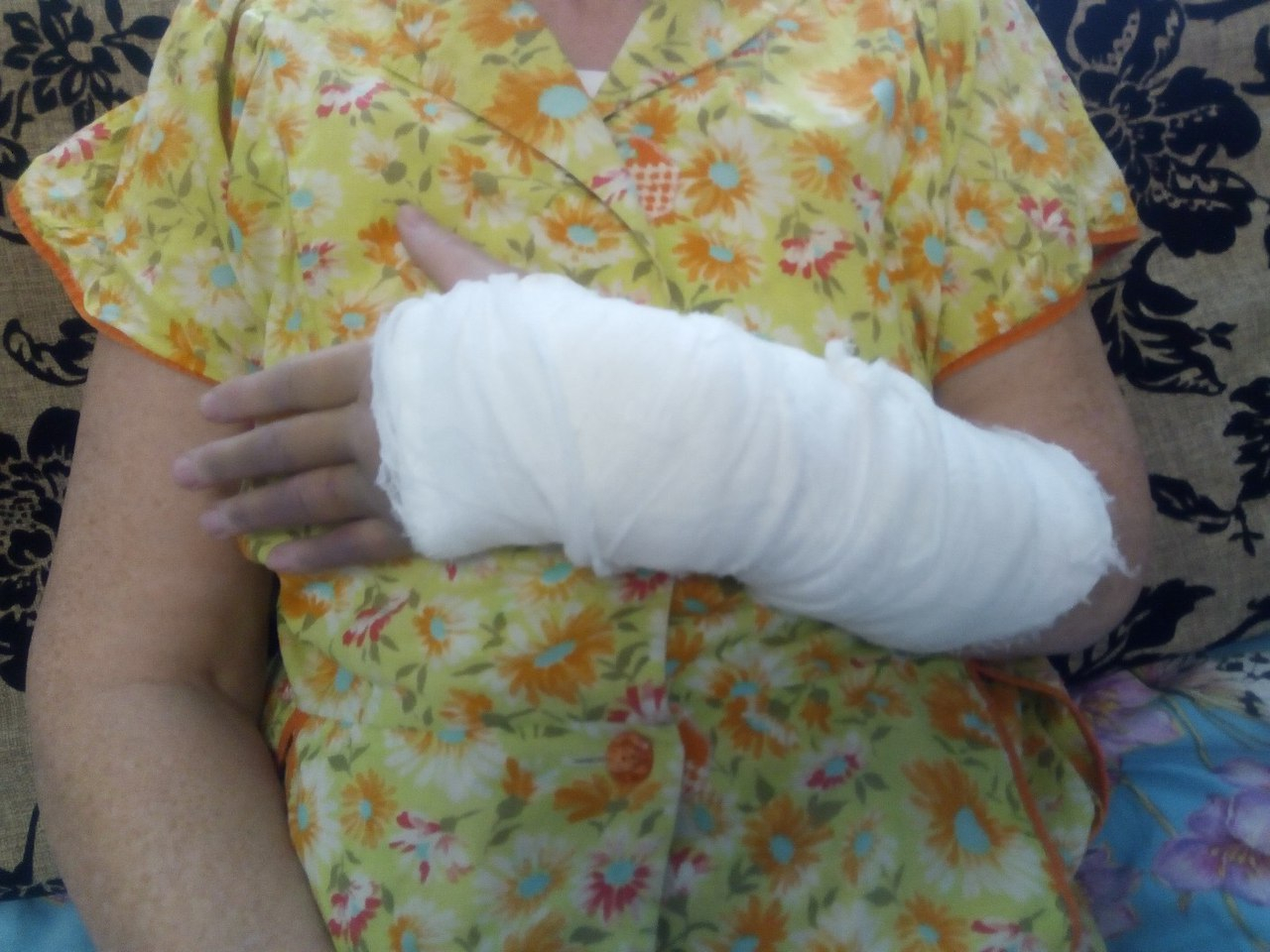 Ярославна пошла за покупкам и сломала руку