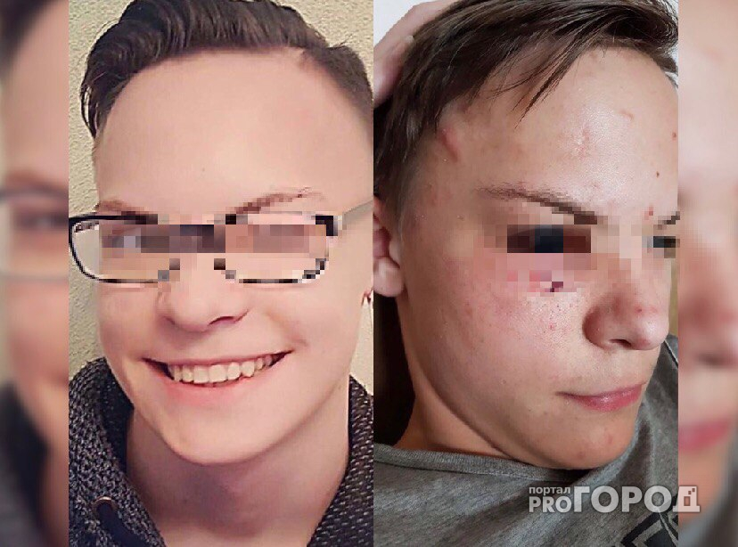 В ярославской школе мальчик избил одноклассника ради шутки: фото