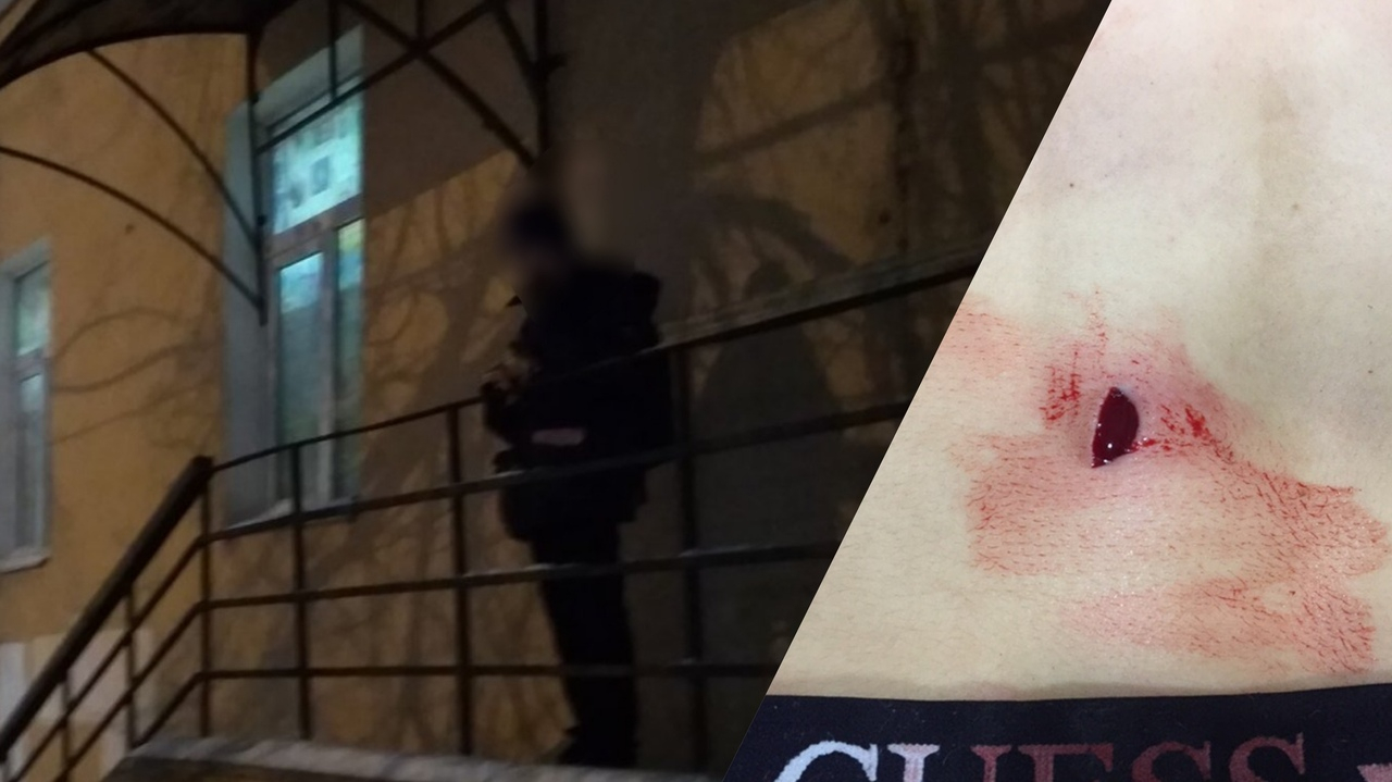 "Ты что, широкий": раненый школьник рассказал о нападении прохожего в центре Ярославля