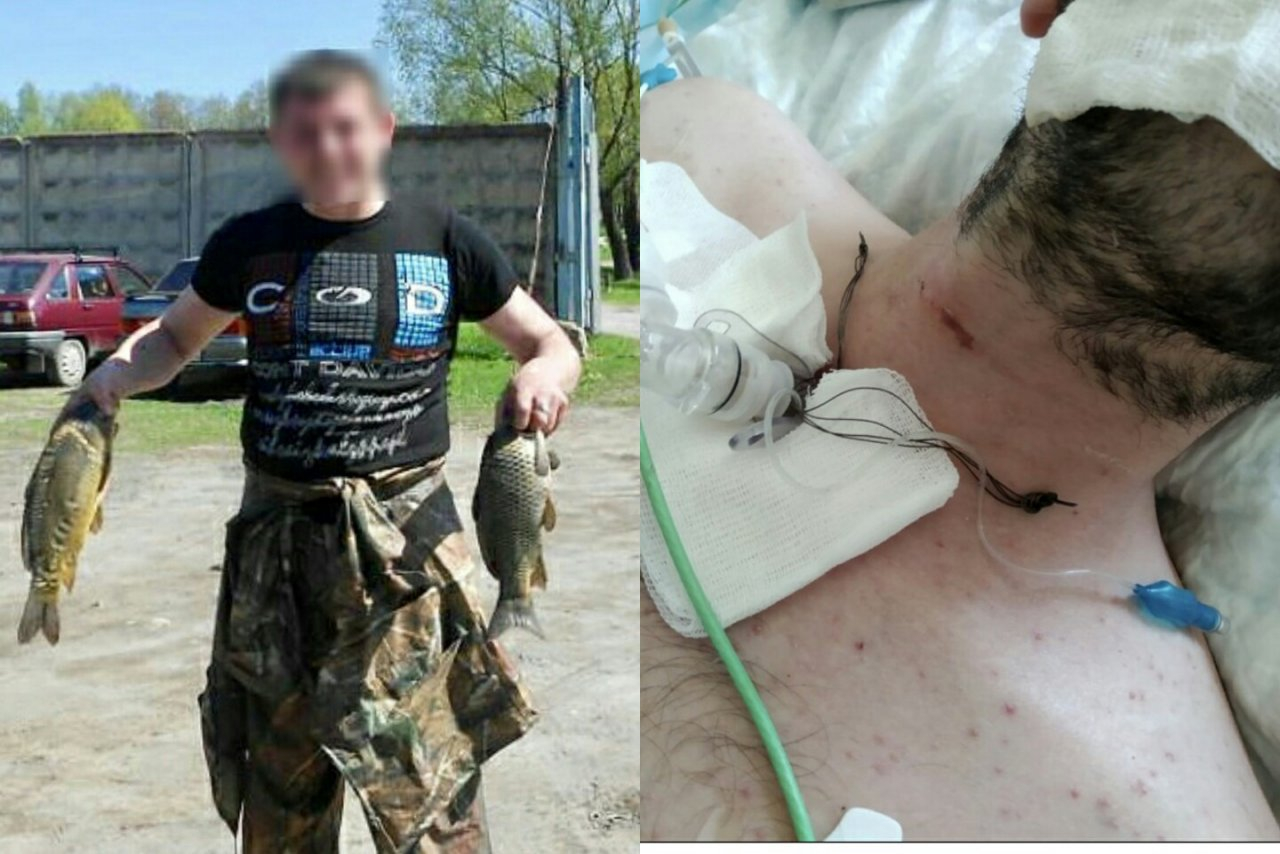 Черепно-мозговая травма и отек мозга: парень умер после двух недель в  ярославском СИЗО