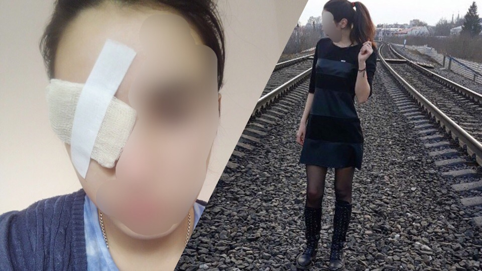 «Сказали, что я не инвалид»: вердикт врачей шокировал девушку, которой выбило глаз петардой