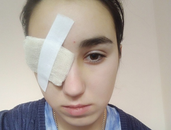 "Пока совсем не ослепнет": ярославне, потерявшей глаз на квесте, отказали в инвалидности