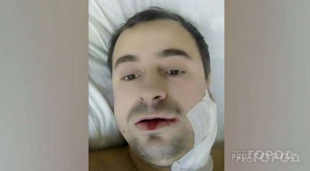 Видел, как ломались бормашины: в больнице  отреагировали на ЧП с ярославцем, которому врач сломал челюсть