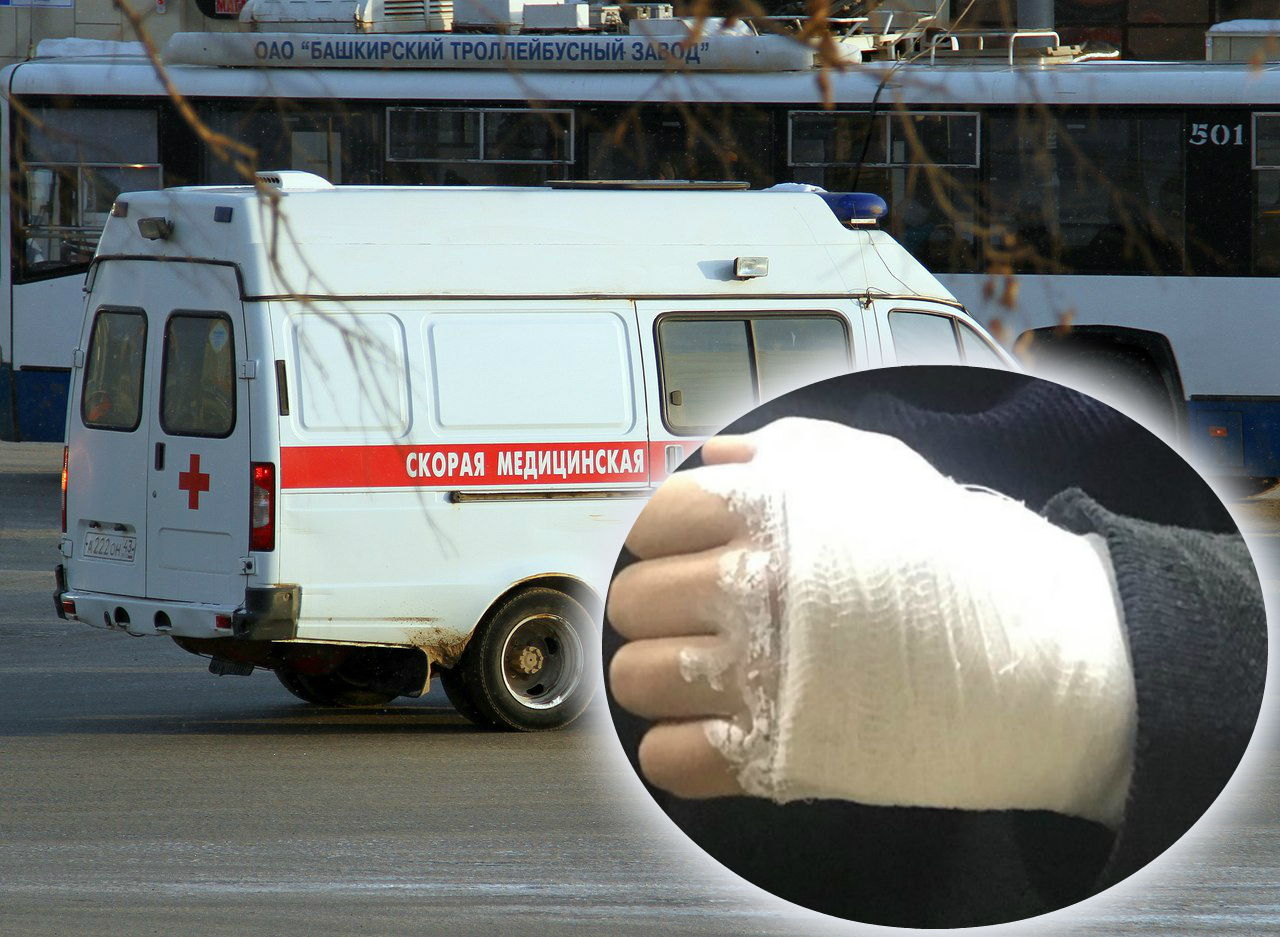 Переломал битой руку: в Ярославле избили мужчину, который вступился за женщину
