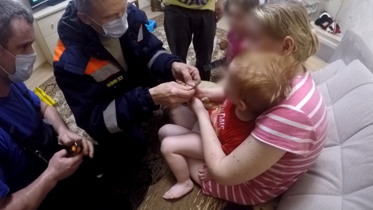 Стал синим и опух: в Ярославле спасли двухгодовалого малыша