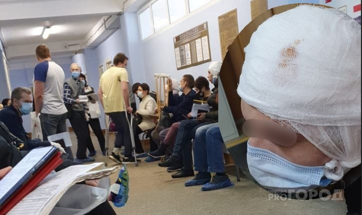 Пробили голову: охранников бара в центре Ярославля обвинили в избиении гостя
