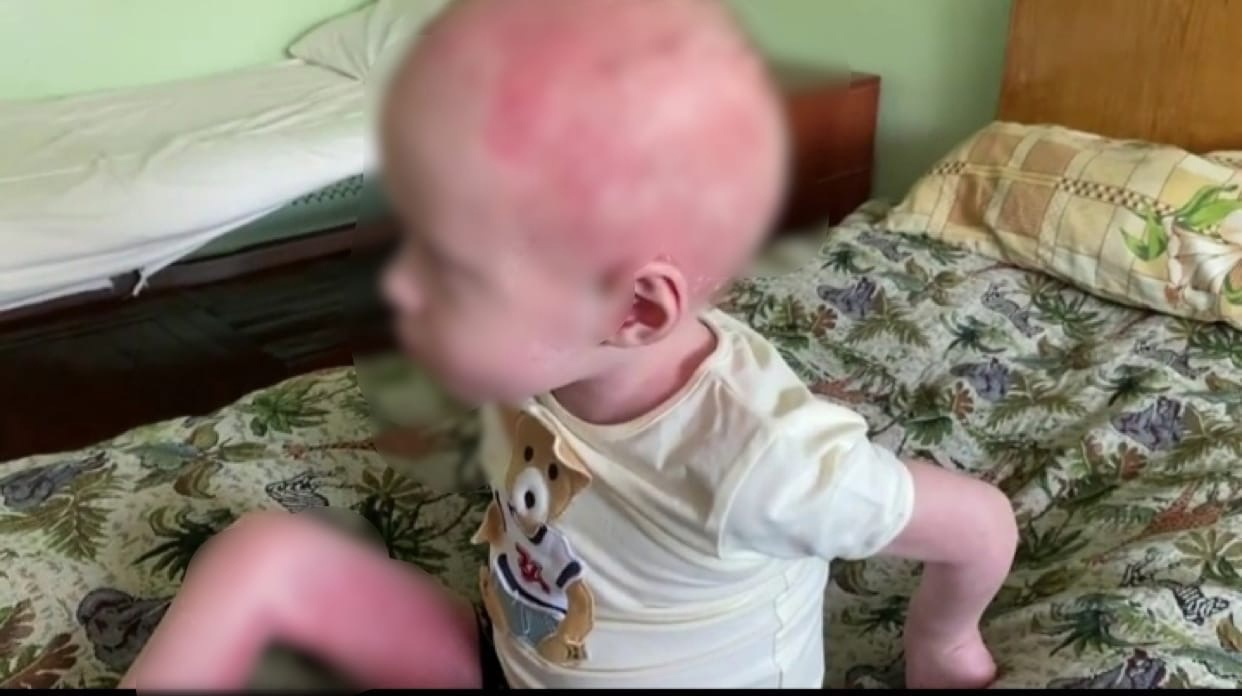 Раскаленной сковородкой по голове: избитый матерью малыш из Рыбинска оказался фейком