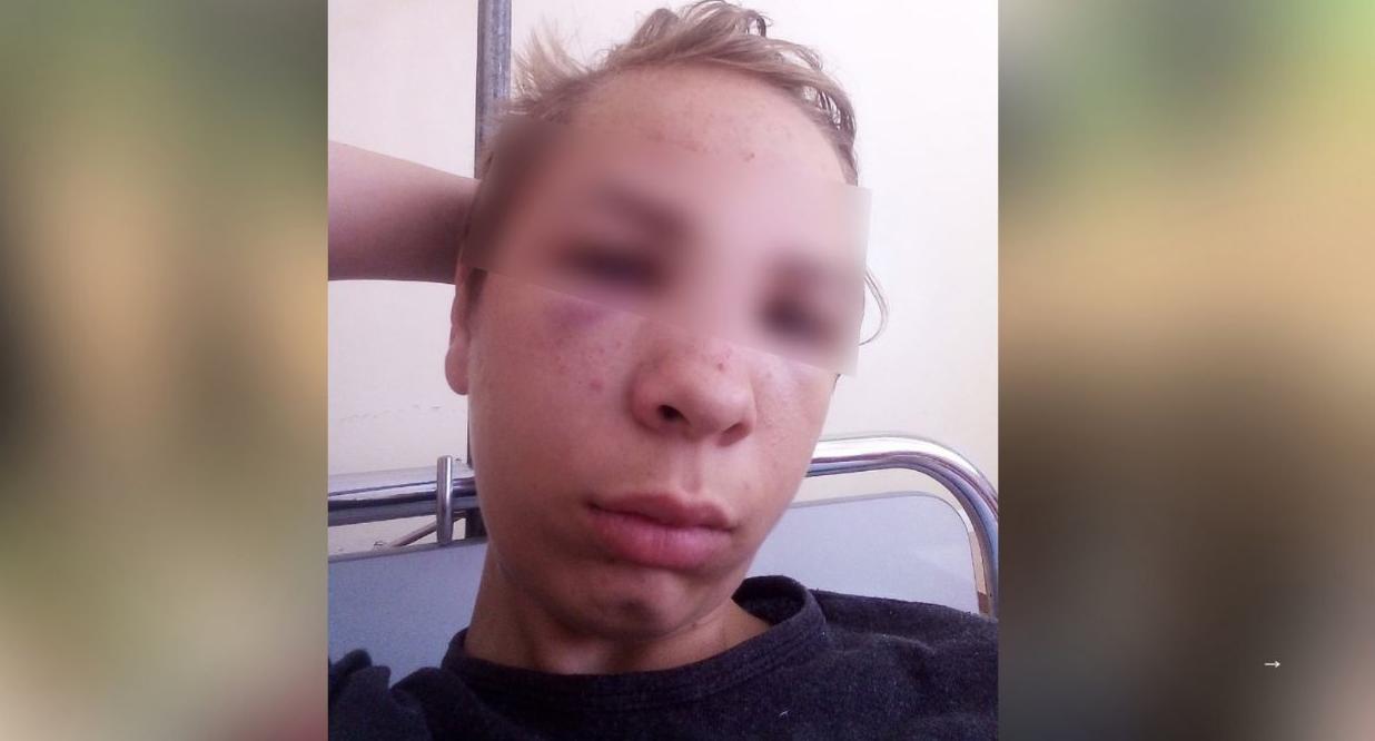 Сломал нос мальчику: избивающего детей мужчину задержали в Ярославской области