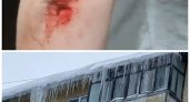 Ярославна хотела заснять опасные сосульки, но стала жертвой гололеда: видео