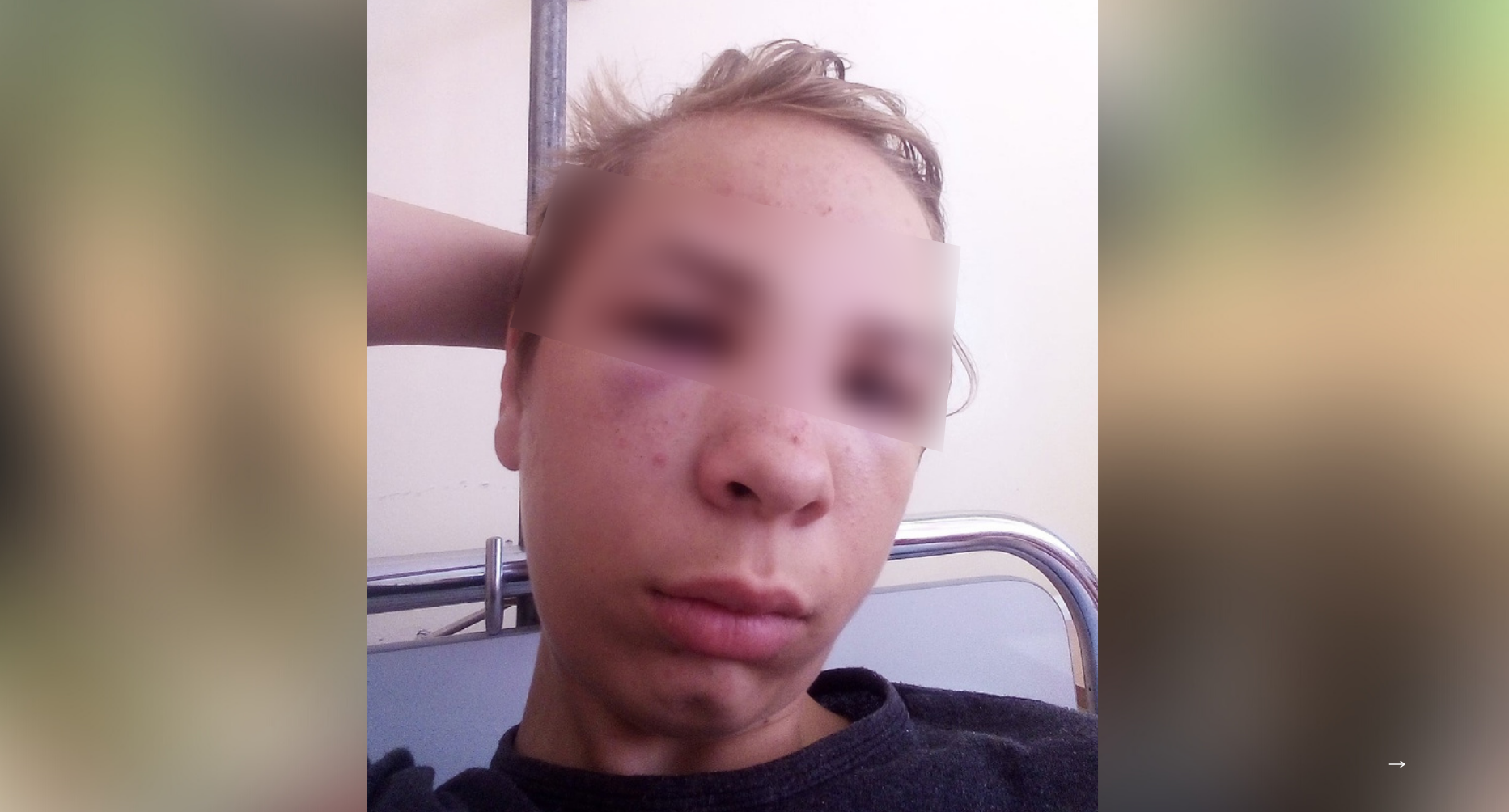 "Он домашний ребенок": в парке прохожий изуродовал мальчика одним ударом