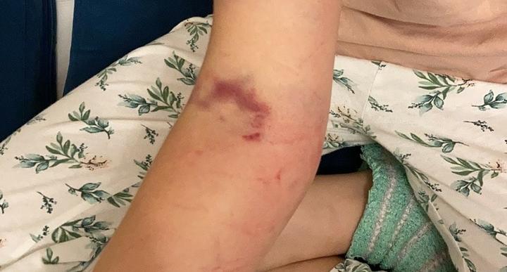 Люди кричали, а он тащил по асфальту: в Ярославле снова зажало ребенка в дверях автобуса