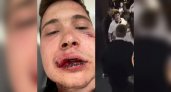 "Прыгал на гостей": комментарий охранника ярославского клуба, в котором избили блогера 