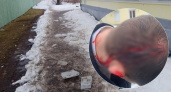 В Ярославской области курсанту рассекло голову глыбой льда с крыши 