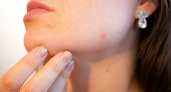 Забудьте о шелушении и сухой коже: Роскачество назвало 7 чудо-кремов