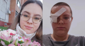 25-летняя ярославна осталась без глаза после атаки БПЛА: "Лена была в коме трое суток"