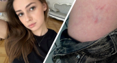 Ярославского фотографа укусила бродячая собака: девушка провела съемку и поехала в травмпункт