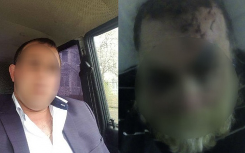 "Трезвым он бы ее не ударил": избитый Дед Мороз из Ярославля о драке в кафе