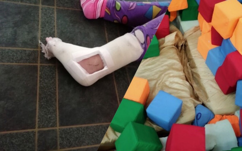 "Сказали резать ногу и вставлять металл": мама покалеченной малышки о ЧП в детском центре Ярославля