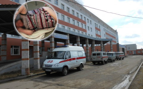 "Она тяжеленная": депздрав пролил свет на скандал с "избиением" пациентки в больнице Гаврилов - Яма