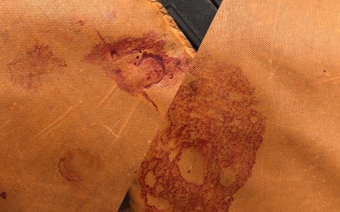 «Увидела на пальцах чужую кровь»: мама рассказала о жутком походе в травмпункт под Ярославлем