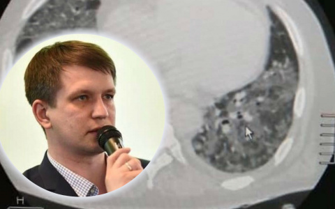 "Для тех, кто не верит в коронавирус": главврач опубликовал шок-фото из больницы Переславля