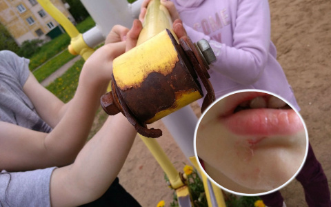 "Подбородок проткнуло насквозь": малышка травмировалась на детской площадке в Ярославле