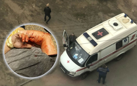 «Спасите, а то убьет»: ярославец напал на свою соседку в Брагино