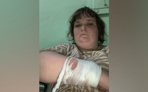 Из-под куртки сочилась кровь: ярославна ищет хозяйку напавшего агрессивного пса