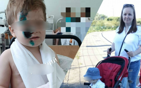 "После ДТП- пересадка кожи и операции": мама сбитого машиной малыша поблагодарила ярославцев за помощь