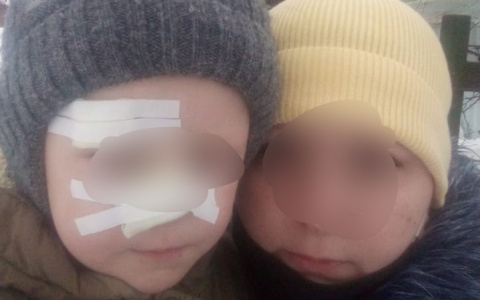 "Разрезал до кости": о кошмаре наяву рассказала мама покалечившегося мальчика