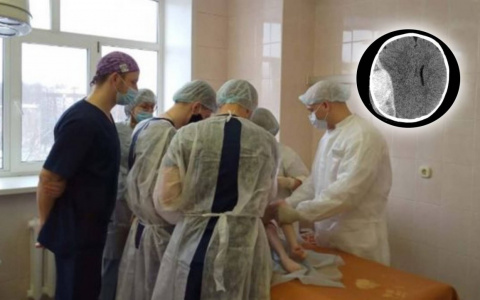 Гематома сдавила полушарие: ярославские хирурги спасли младенца с переломом черепа