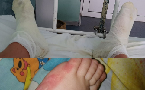 "Выносил детей на руках, шлепая по кипятку": в Рыбинске обварилась семья