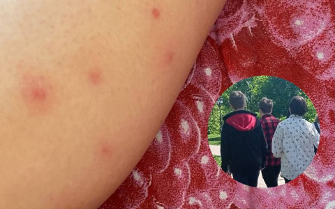 100 укусов за ночь: африканские кожееды атаковали Заволжский район